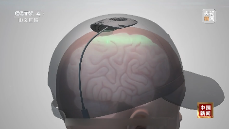 我国科学家在世界上首次绘制!事关脑科学