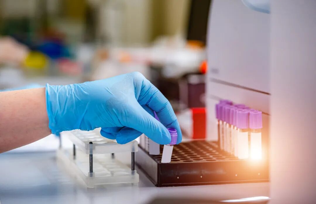 癌症早筛明星陨落 诺辉健康梦碎港股