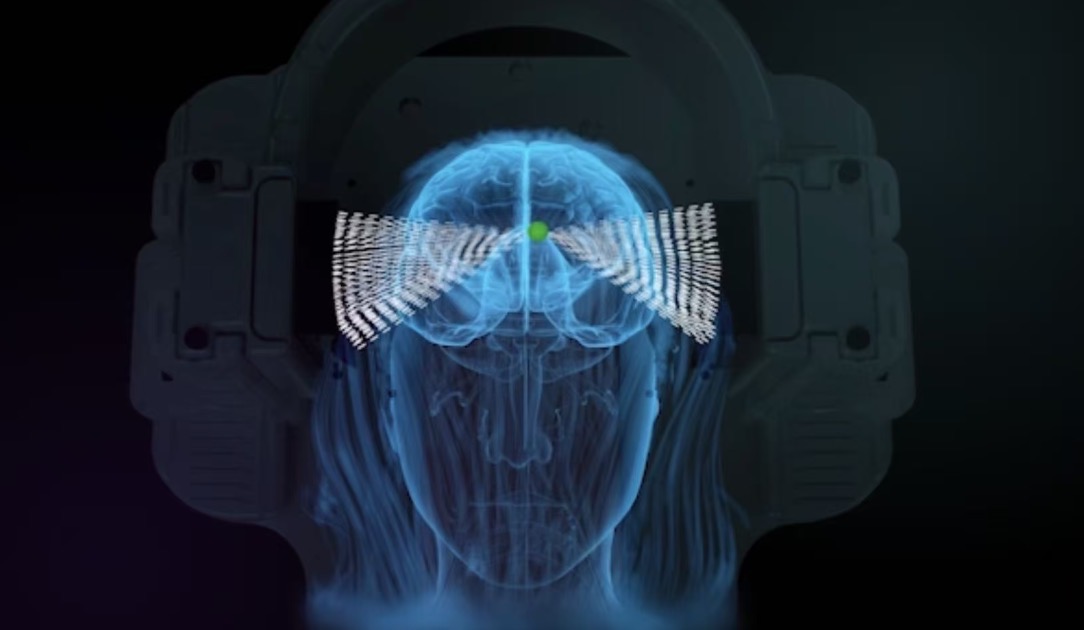 陈天桥再投资！押注中国首家超声波脑机接口公司-313啦实用网